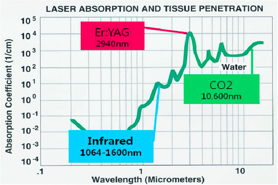 Acrylic absorption efficiency of CO ₂ laser